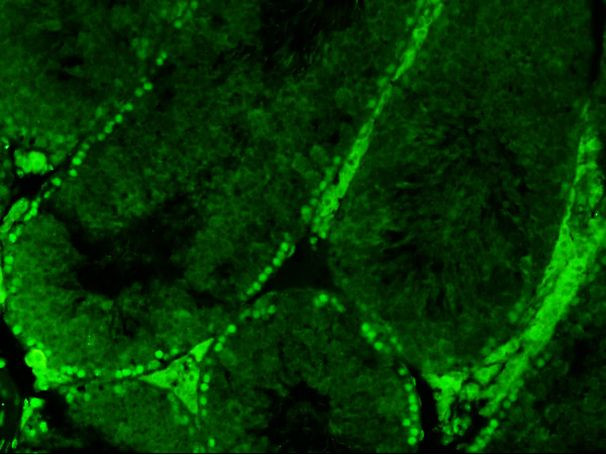 Phospho-HSP90 alpha (Thr5, Thr7) Antibody in Immunohistochemistry (Paraffin) (IHC (P))