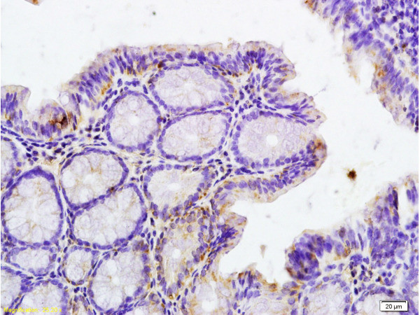 Phospho-IRAK1 (Thr209) Antibody in Immunohistochemistry (Paraffin) (IHC (P))