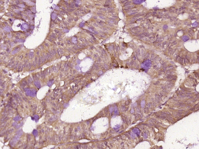 Phospho-IRAK1 (Thr209) Antibody in Immunohistochemistry (Paraffin) (IHC (P))