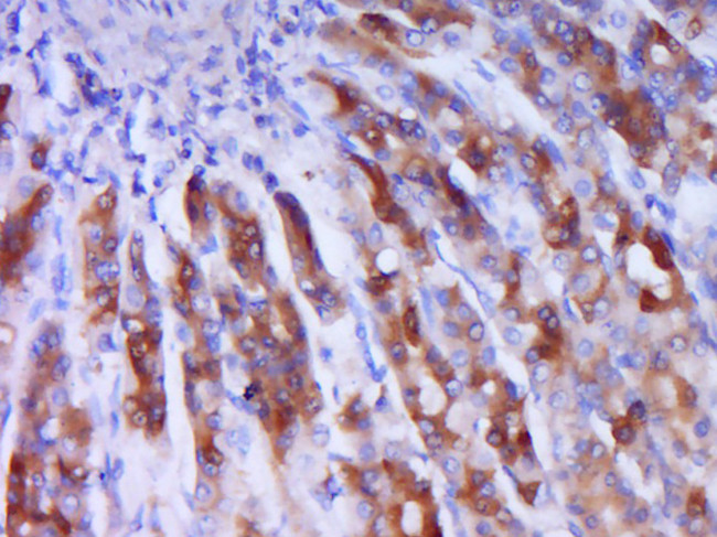 Phospho-IRS1 (Ser1101) Antibody in Immunohistochemistry (Paraffin) (IHC (P))