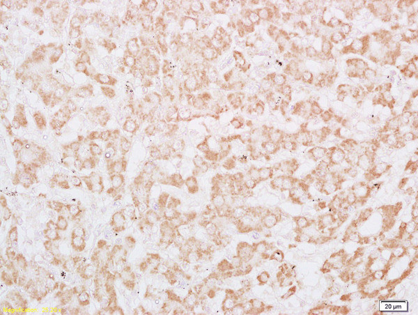 Phospho-IRS1 (Tyr612) Antibody in Immunohistochemistry (Paraffin) (IHC (P))