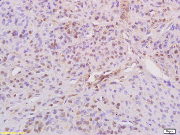 Phospho-IRS1 (Ser636, Ser639) Antibody in Immunohistochemistry (Paraffin) (IHC (P))