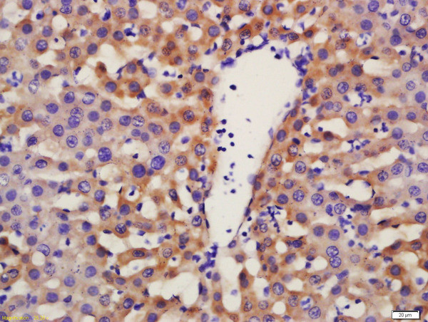 Phospho-FGFR1 (Tyr653, Tyr654) Antibody in Immunohistochemistry (Paraffin) (IHC (P))