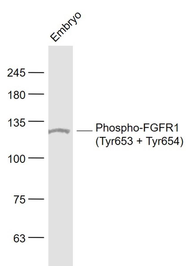 Phospho-FGFR1 (Tyr653, Tyr654) Antibody in Western Blot (WB)