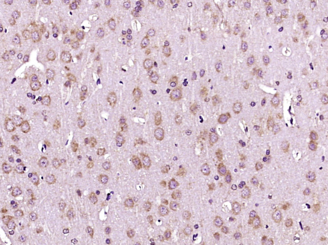 Phospho-HER3 (Tyr1197) Antibody in Immunohistochemistry (Paraffin) (IHC (P))