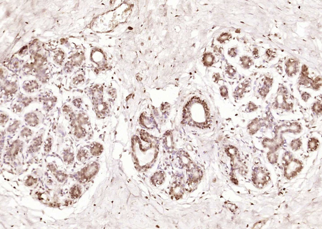 Phospho-HER4 (Tyr1284) Antibody in Immunohistochemistry (Paraffin) (IHC (P))