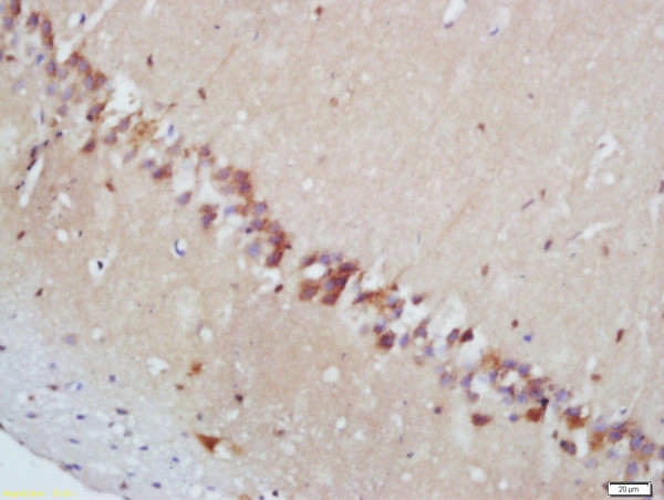 Phospho-MAPKAPK2 (Thr222) Antibody in Immunohistochemistry (Paraffin) (IHC (P))