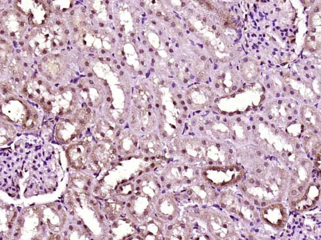 Phospho-MAPKAPK2 (Thr222) Antibody in Immunohistochemistry (Paraffin) (IHC (P))