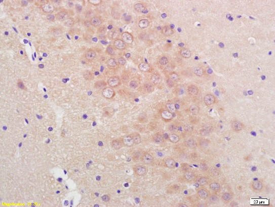 Phospho-Mcl1 (Ser159, Thr163) Antibody in Immunohistochemistry (Paraffin) (IHC (P))