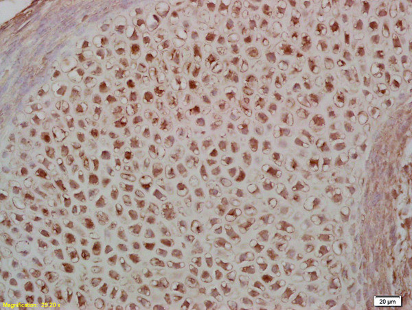 Phospho-MEF2A (Thr312) Antibody in Immunohistochemistry (Paraffin) (IHC (P))