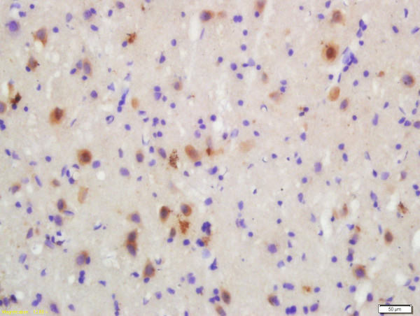 Phospho-MKK3 (Ser218, Ser207) Antibody in Immunohistochemistry (Paraffin) (IHC (P))