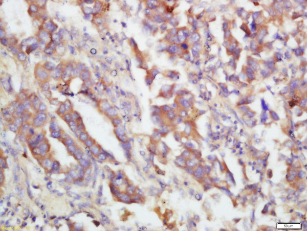 Phospho-MKK3 (Ser218, Ser207) Antibody in Immunohistochemistry (Paraffin) (IHC (P))