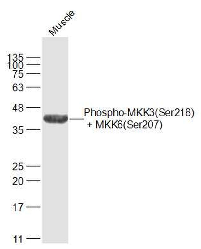 Phospho-MKK3 (Ser218, Ser207) Antibody in Western Blot (WB)