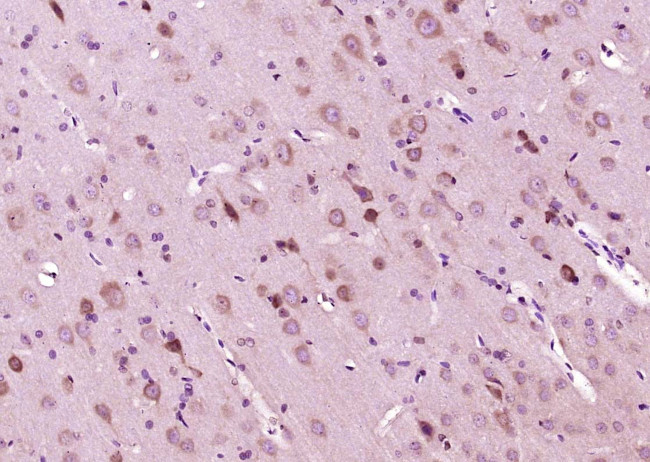 Phospho-MEK6 (Ser207) Antibody in Immunohistochemistry (Paraffin) (IHC (P))