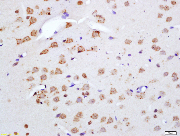 Phospho-Merlin (Ser518) Antibody in Immunohistochemistry (Paraffin) (IHC (P))