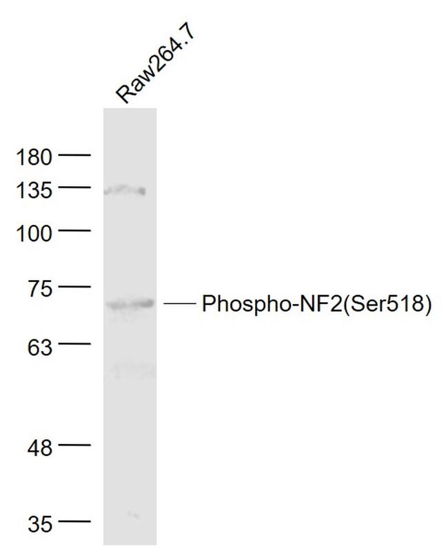 Phospho-Merlin (Ser518) Antibody in Western Blot (WB)