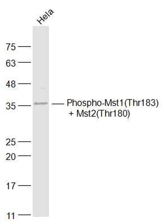 Phospho-Mst1/Mst2 (Thr183, Thr180) Antibody in Western Blot (WB)