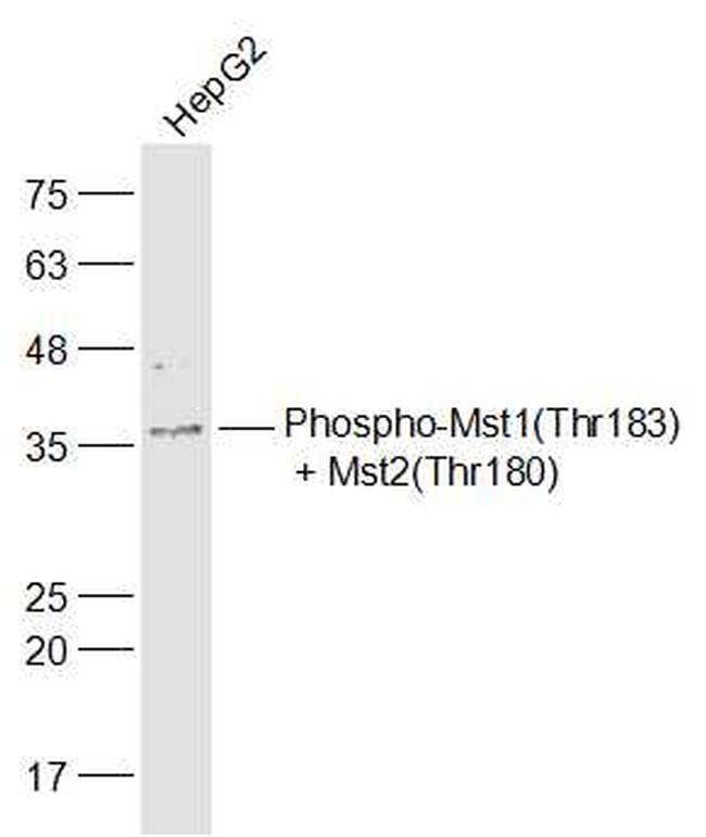 Phospho-Mst1/Mst2 (Thr183, Thr180) Antibody in Western Blot (WB)