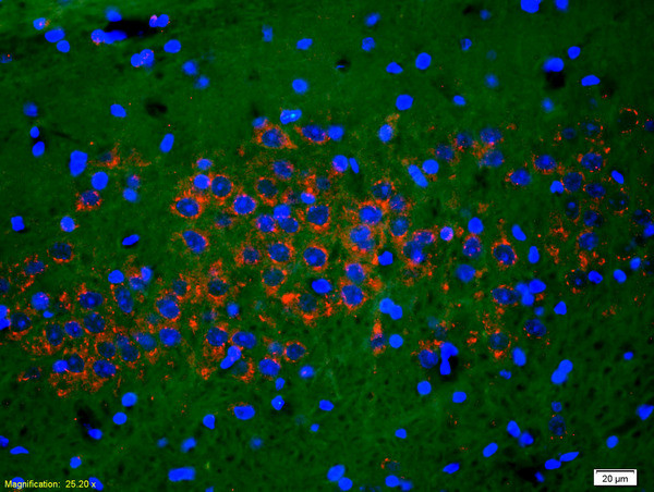 Phospho-NMDAR1 (Ser890) Antibody in Immunohistochemistry (Paraffin) (IHC (P))