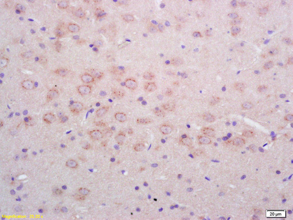 Phospho-NMDAR1 (Ser890) Antibody in Immunohistochemistry (Paraffin) (IHC (P))