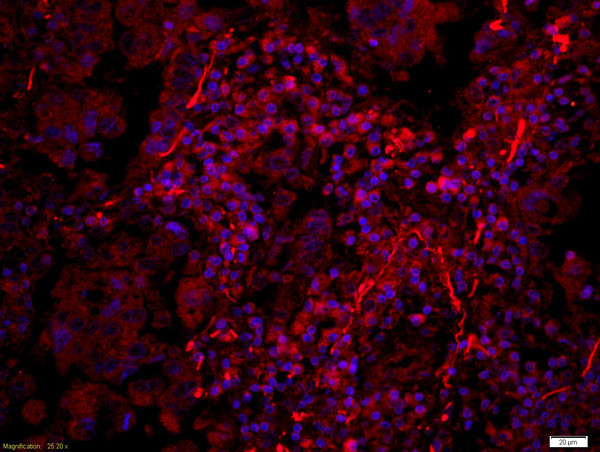 Phospho-PERK (Thr980) Antibody in Immunohistochemistry (Paraffin) (IHC (P))