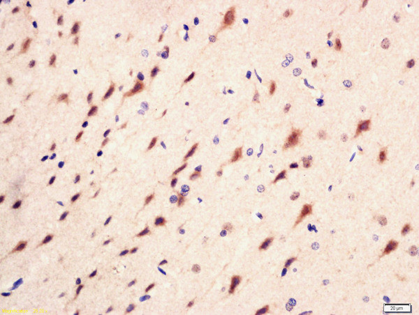 Phospho-PI3 kinase p85 alpha/gamma (Tyr467, Tyr199) Antibody in Immunohistochemistry (Paraffin) (IHC (P))