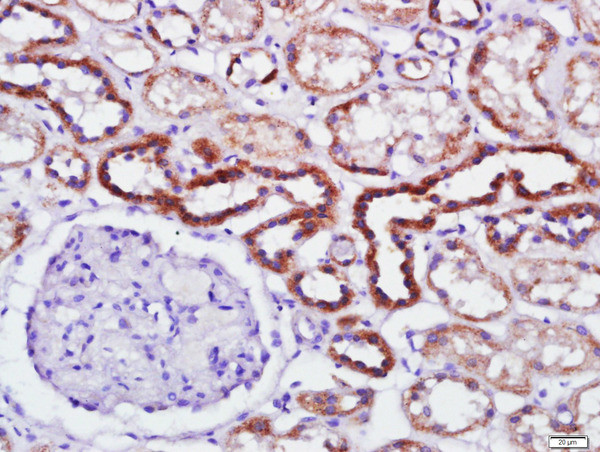 Phospho-PKR (Thr446) Antibody in Immunohistochemistry (Paraffin) (IHC (P))