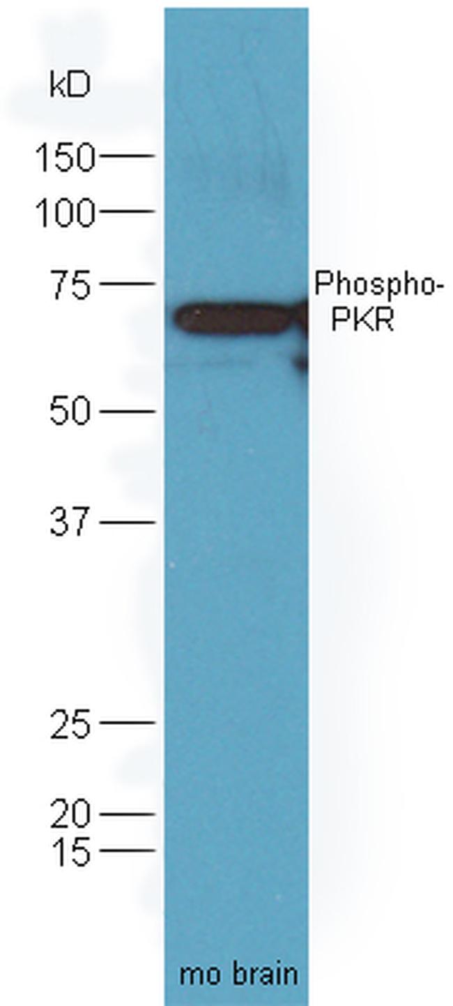 Phospho-PKR (Thr446) Antibody in Western Blot (WB)