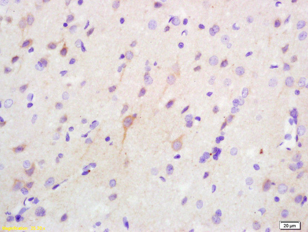 Phospho-PKR (Thr446, Thr451) Antibody in Immunohistochemistry (Paraffin) (IHC (P))