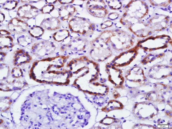 Phospho-PKR (Thr446, Thr451) Antibody in Immunohistochemistry (Paraffin) (IHC (P))