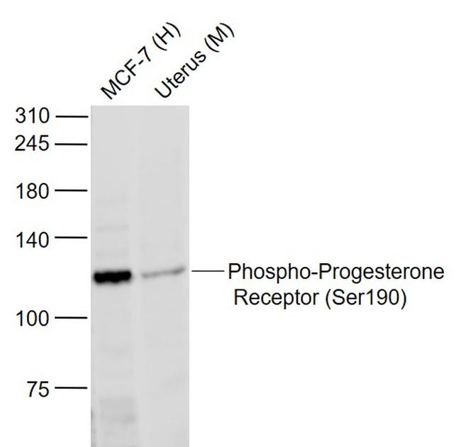 Phospho-Progesterone Receptor (Ser190) Antibody in Western Blot (WB)