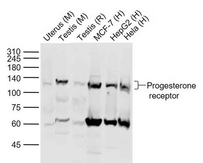 Phospho-Progesterone Receptor (Ser190) Antibody in Western Blot (WB)