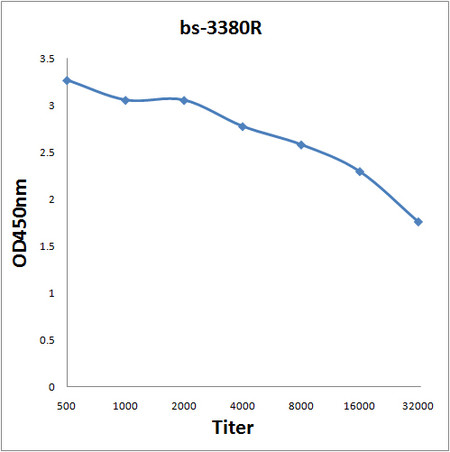 Phospho-Rb/P105 RB (Ser807, Ser811) Antibody in ELISA (ELISA)