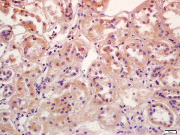 Phospho-SGK1 (Ser78) Antibody in Immunohistochemistry (Paraffin) (IHC (P))