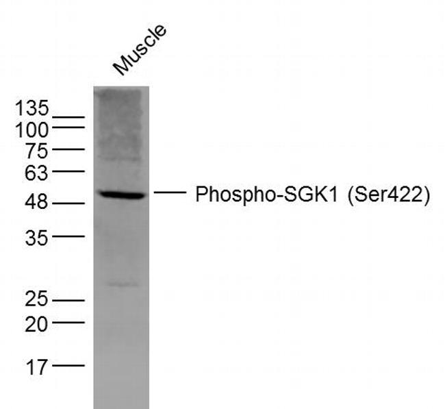 Phospho-SGK1 (Ser422) Antibody in Western Blot (WB)