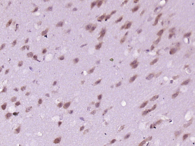 Phospho-INPPL1 (Tyr1135) Antibody in Immunohistochemistry (Paraffin) (IHC (P))