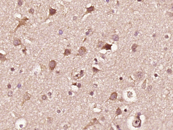 Phospho-INPPL1 (Tyr1135) Antibody in Immunohistochemistry (Paraffin) (IHC (P))