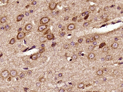 Phospho-Pyk2 (Tyr402) Antibody in Immunohistochemistry (Paraffin) (IHC (P))