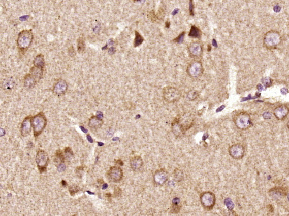 Phospho-Pyk2 (Tyr402) Antibody in Immunohistochemistry (Paraffin) (IHC (P))