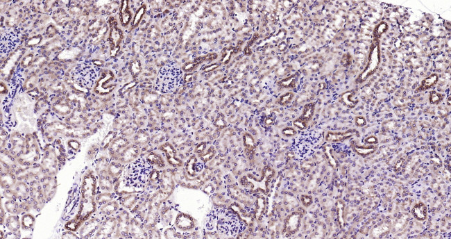 PEPT1 Antibody in Immunohistochemistry (Paraffin) (IHC (P))