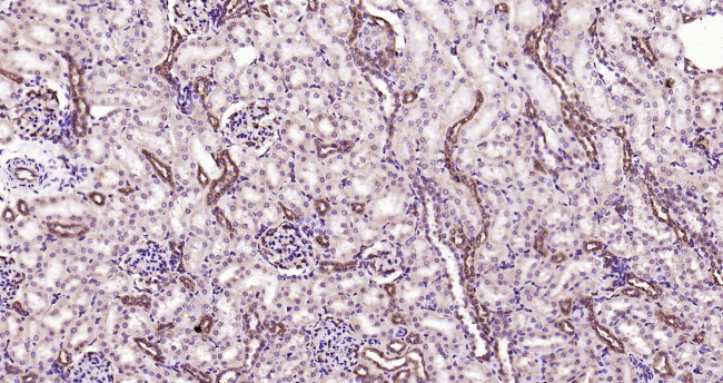 PEPT1 Antibody in Immunohistochemistry (Paraffin) (IHC (P))