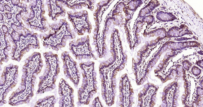 PEPT1 Antibody in Immunohistochemistry (Paraffin) (IHC (P))