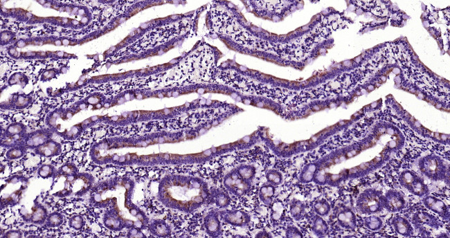 PEPT1 Antibody in Immunohistochemistry (Paraffin) (IHC (P))