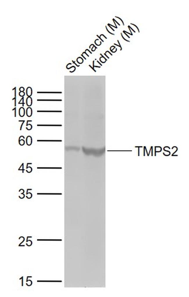 TMPS2 Antibody in Western Blot (WB)