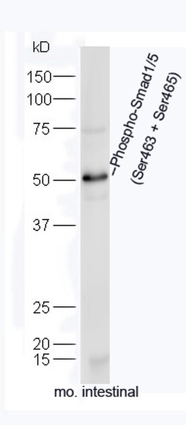 Phospho-Smad1/5 (Ser463, Ser465) Antibody in Western Blot (WB)