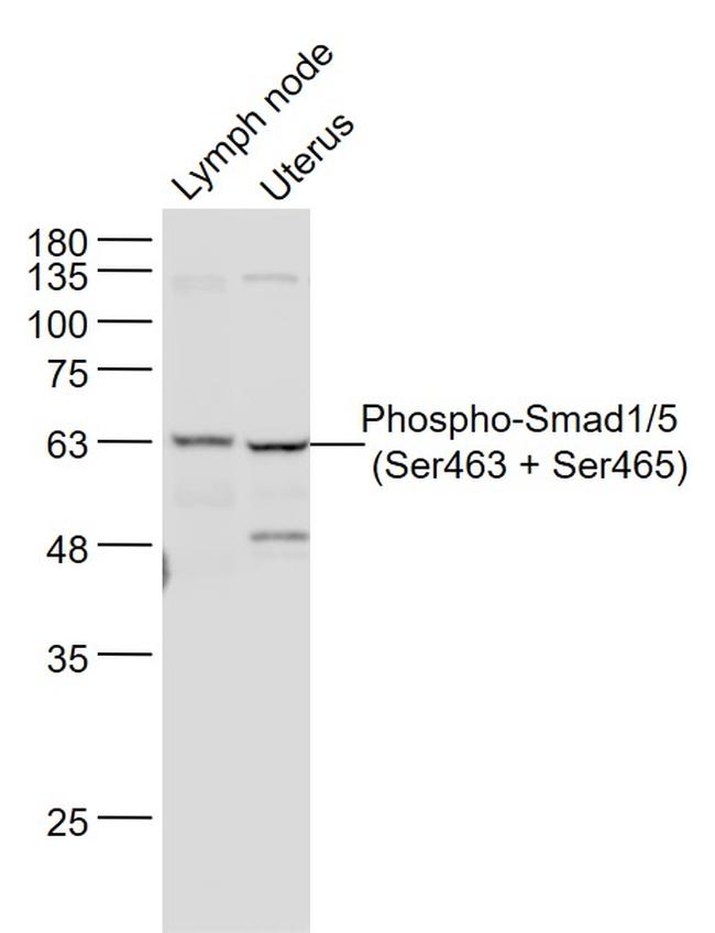 Phospho-Smad1/5 (Ser463, Ser465) Antibody in Western Blot (WB)