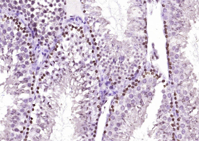 Phospho-Smad2 (Ser465, Ser467) Antibody in Immunohistochemistry (Paraffin) (IHC (P))