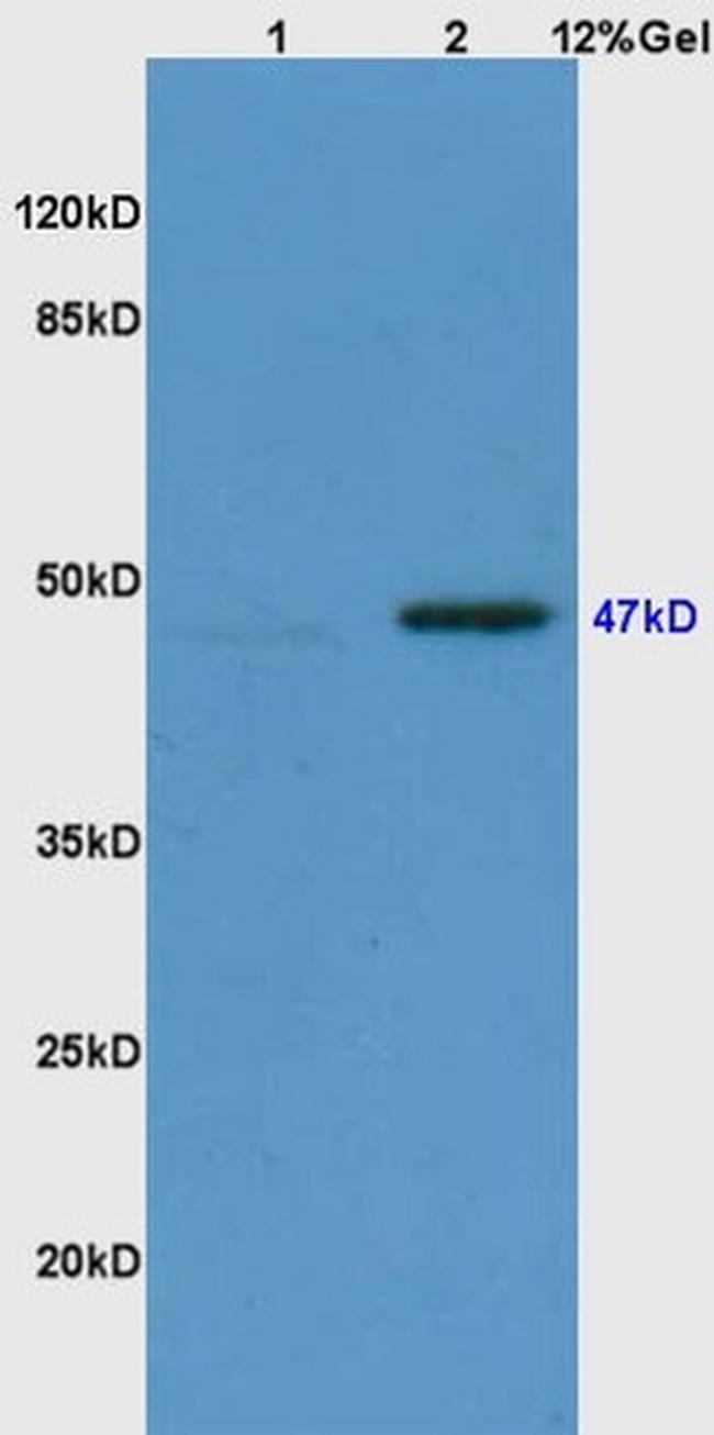 Phospho-Smad3 (Ser423, Ser425) Antibody in Western Blot (WB)