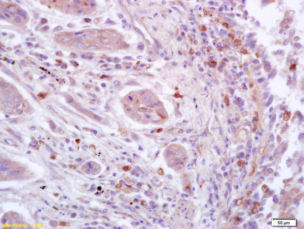 Phospho-STAT3 (Ser727) Antibody in Immunohistochemistry (Paraffin) (IHC (P))