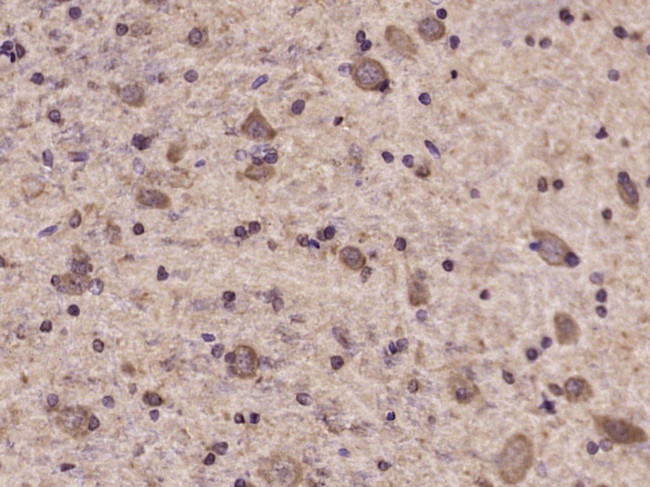 Phospho-Tyk2 (Tyr1054, Tyr1055) Antibody in Immunohistochemistry (Paraffin) (IHC (P))